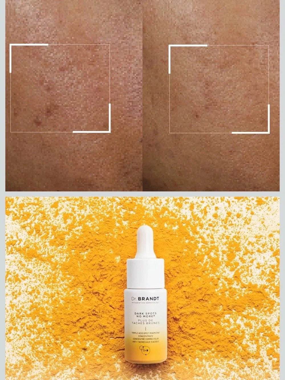 Dr. Brandt White to Yellow Dark Spots No More Triple Acid Concentrate